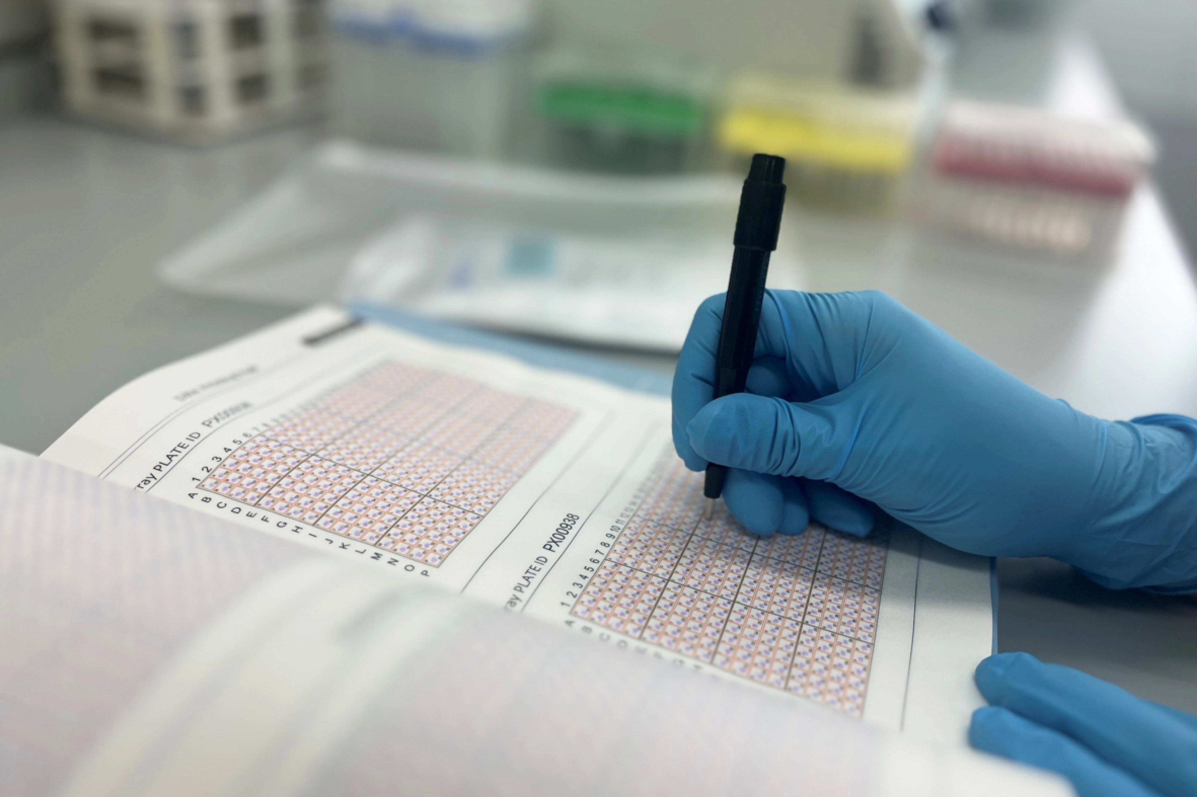 Hand with blue gloves holding a black pen en clones.